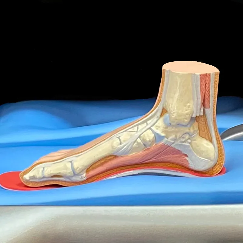 ski boot injury prevention